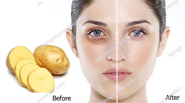 Trong khoai tây chứa nhiều thành phần giúp xóa tan quầng thâm, bọng mắt